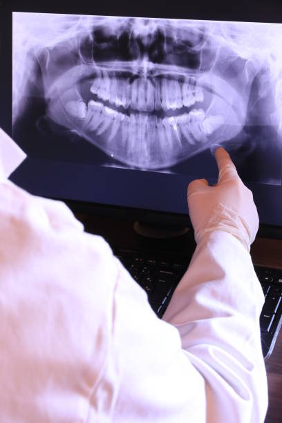 Best Emergency Root Canal Treatment in Fairview, OK