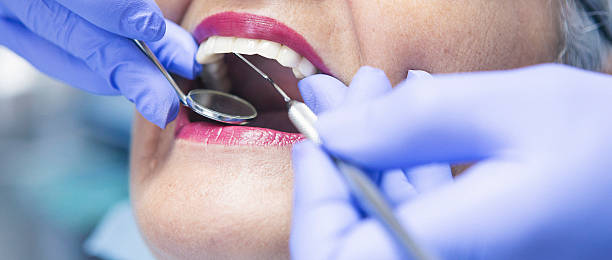 Best Emergency Root Canal Treatment in Fairview, OK