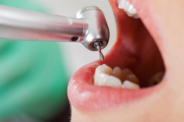 Best Emergency Broken Tooth Repair in Fairview, OK